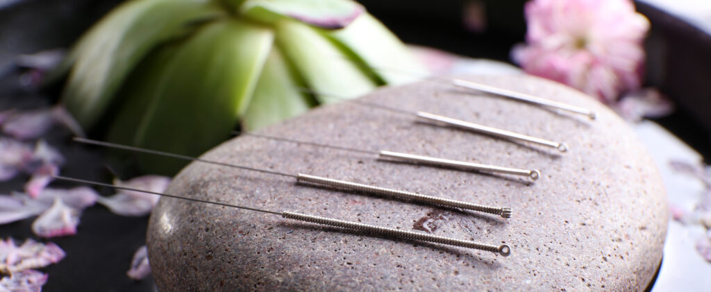 Acupuncture needles with spa stone on tray, closeup